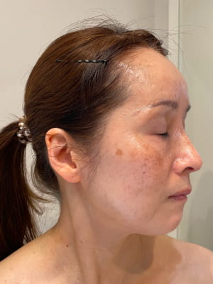 使用前